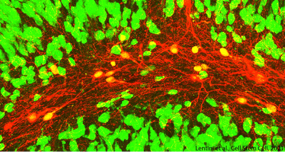 Comment corriger l'erreur 'Mixed Content' sur WordPress en 2026 ?