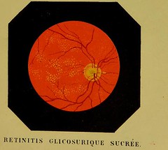 Quelles sont les meilleures pratiques SEO pour un site de psychologue ?